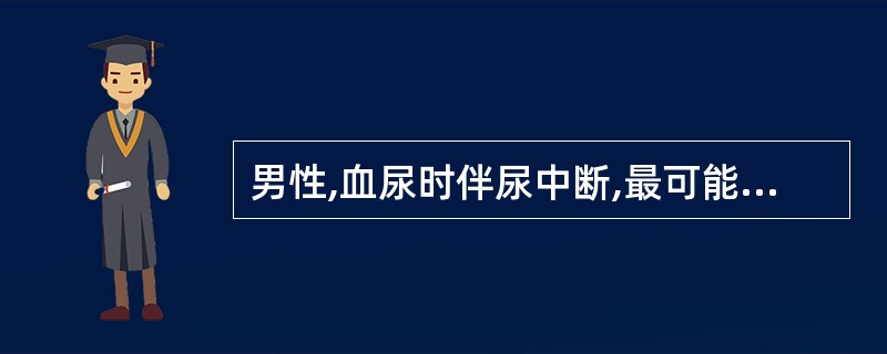 男性,血尿时伴尿中断,最可能的诊断为 ( )A、膀胱血块B、膀胱结石C、膀胱肿瘤