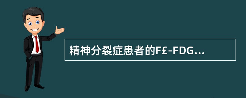 精神分裂症患者的F£­FDG脑葡萄糖代谢显像通常表现为