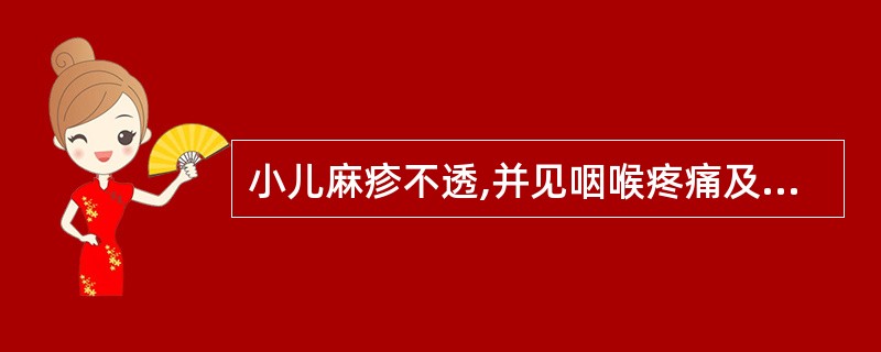 小儿麻疹不透,并见咽喉疼痛及大便秘结,下列药物中最宜选A、薄荷B、蝉蜕C、葛根D