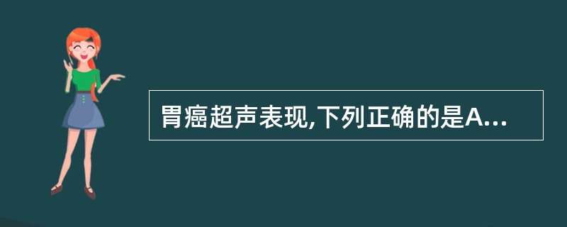 胃癌超声表现,下列正确的是A、胃壁弥漫性或局限性增厚,呈高回声B、胃癌超声分为三