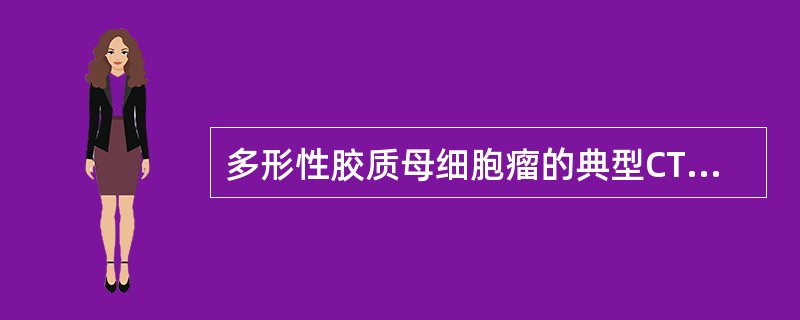 多形性胶质母细胞瘤的典型CT表现为A、病灶不均匀强化B、花环样环状强化C、病灶边