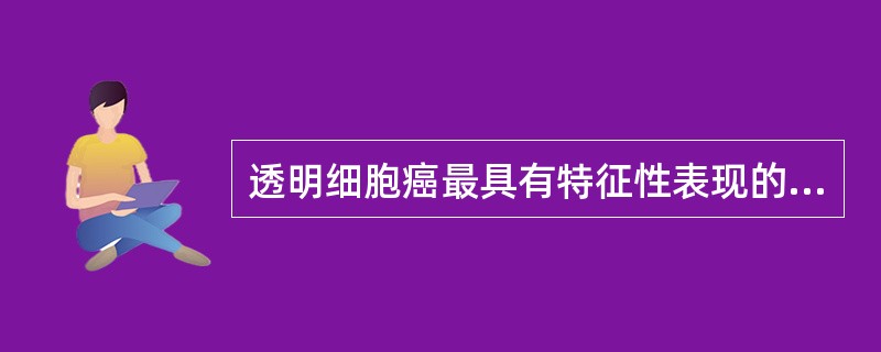 透明细胞癌最具有特征性表现的是A、平扫CT呈混杂密度的肿块B、肿块突向肾外生长,