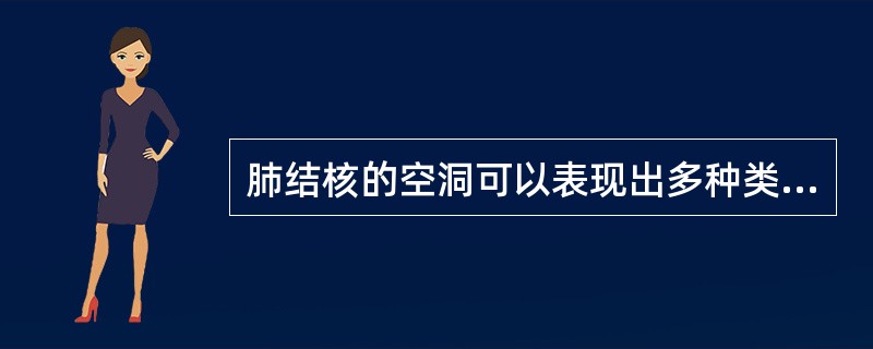 肺结核的空洞可以表现出多种类型,但下列一般不出现的是A、虫蚀样空洞B、薄壁空洞C