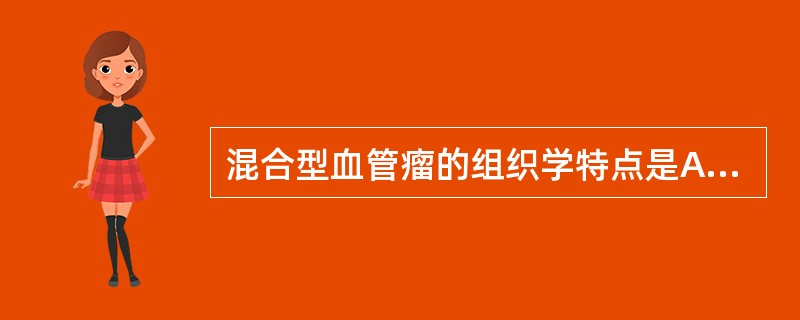 混合型血管瘤的组织学特点是A、由毛细血管构成B、由血窦构成C、由小静脉构成D、由