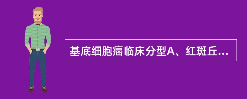 基底细胞癌临床分型A、红斑丘疹型、结节溃疡型、斑块型、肿瘤型B、结节溃疡型、硬斑