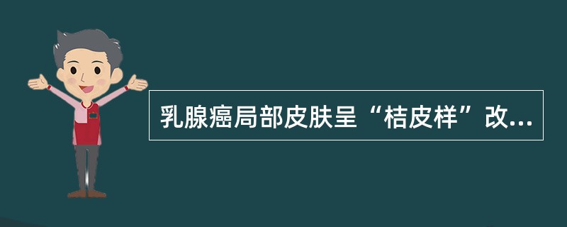 乳腺癌局部皮肤呈“桔皮样”改变的原因( )。A、肿物压迫B、癌肿侵及Cooper