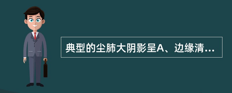 典型的尘肺大阴影呈A、边缘清楚,分散孤立的致密影B、对称的在双肺上中野中外带,呈