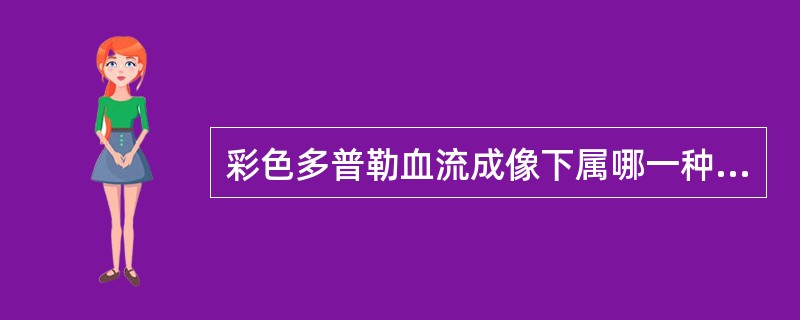 彩色多普勒血流成像下属哪一种性能是正确的?