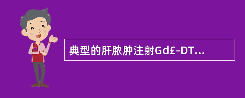 典型的肝脓肿注射Gd£­DTPA后,增强的脓腔壁如:()。