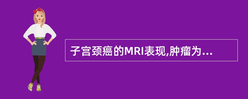 子宫颈癌的MRI表现,肿瘤为:()。A、T1WI呈高信号,T2WI呈低信号B、T