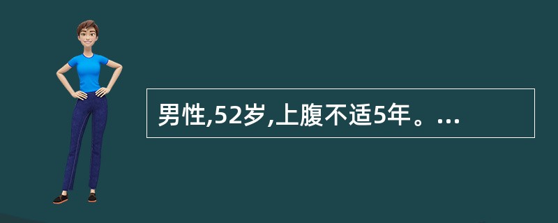 男性,52岁,上腹不适5年。胃镜检查:胃窦黏膜可透见血管网,胃酸分泌正常( )