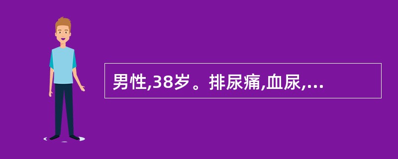 男性,38岁。排尿痛,血尿,排尿困难。该患者的诊断可能是A、肾结石B、肾盂肾炎C