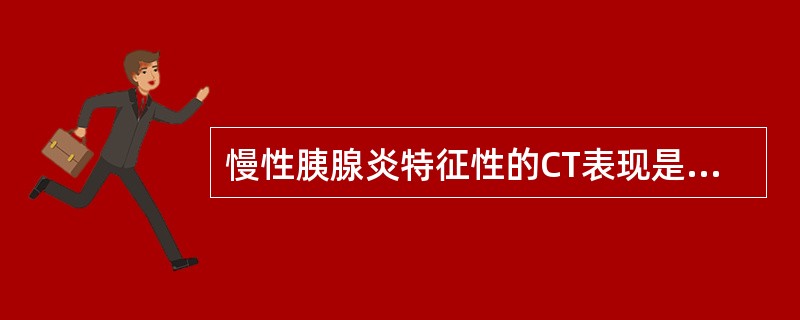 慢性胰腺炎特征性的CT表现是:()。A、胰腺增大或萎缩B、胰管扩张或狭C、胰腺和