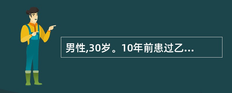 男性,30岁。10年前患过乙型肝炎,近1周来纳差、乏力、腹胀不适,2天来尿色加深