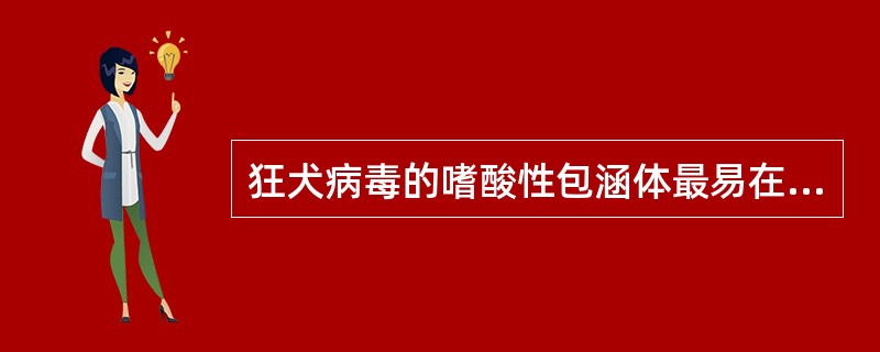 狂犬病毒的嗜酸性包涵体最易在下列哪种组织中检出:A、淋巴结B、血液C、脑组织D、