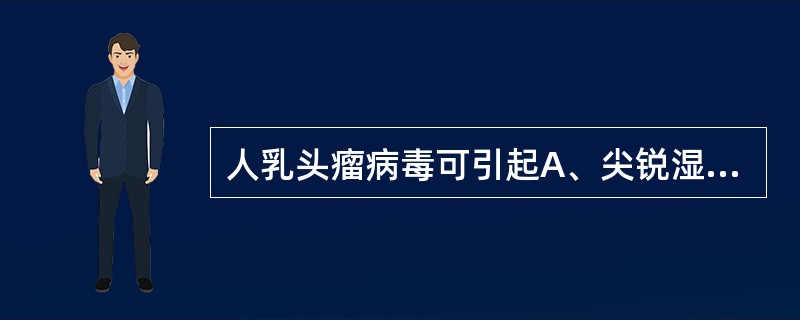 人乳头瘤病毒可引起A、尖锐湿疣B、获得性免疫缺陷征C、淋病D、生殖器疱疹E、梅毒