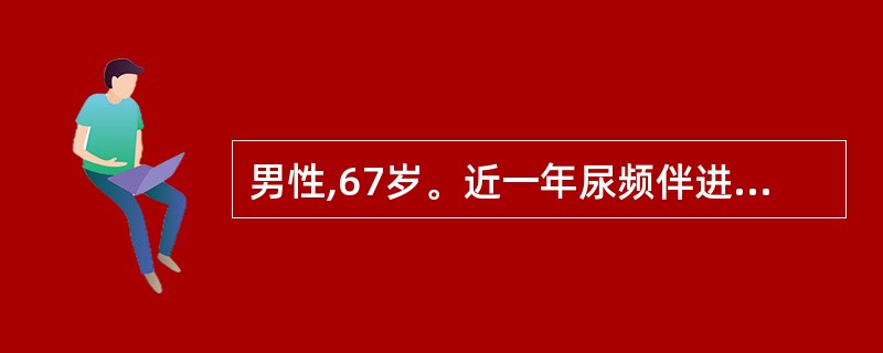 男性,67岁。近一年尿频伴进行性排尿困难,无明显尿痛。该患者可能是A、肾盂肾炎B