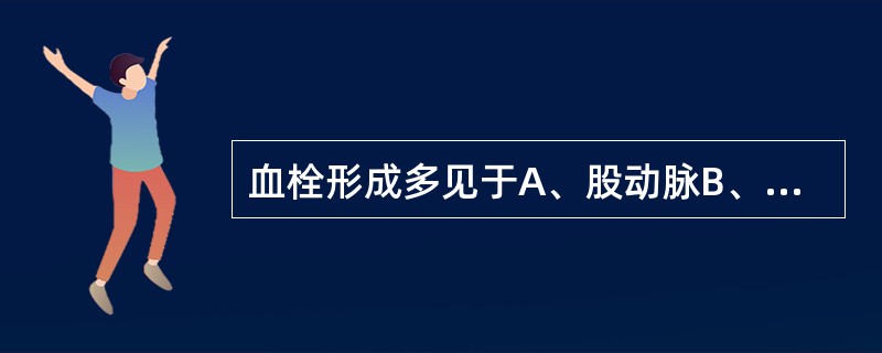 血栓形成多见于A、股动脉B、右心房C、股静脉D、肱静脉E、下腔静脉