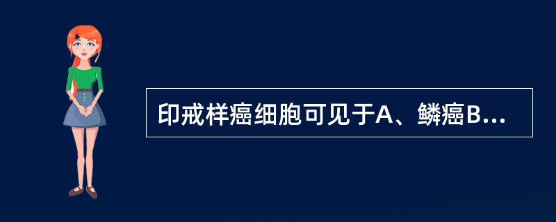 印戒样癌细胞可见于A、鳞癌B、霍奇金淋巴瘤C、腺癌D、移行细胞癌E、未分化癌 -