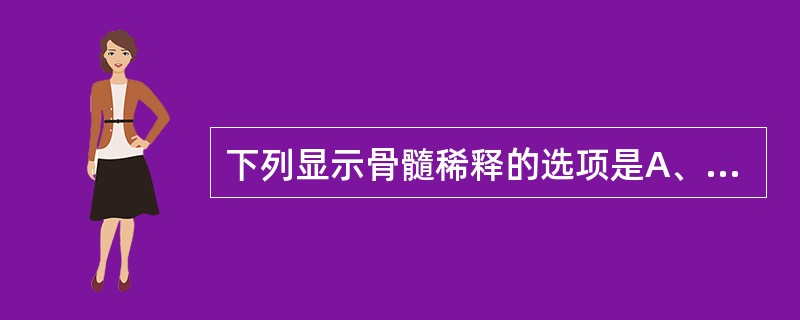 下列显示骨髓稀释的选项是A、骨髓有核细胞增生低下或极度低下B、未见骨髓小粒及脂肪