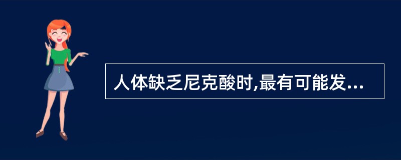 人体缺乏尼克酸时,最有可能发生的症状是A、坏血病B、脚气病C、癞皮病D、夜盲症E