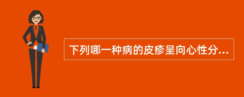 下列哪一种病的皮疹呈向心性分布( )A、流行性斑疹伤寒B、洛矶山斑点热C、Q热D