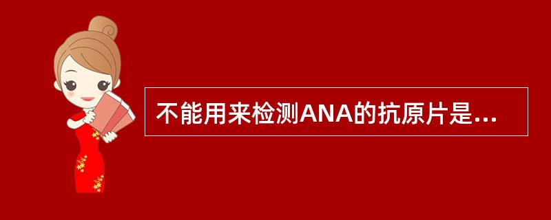 不能用来检测ANA的抗原片是A、鸡有核红细胞B、绵羊红细胞C、大鼠肾细胞D、大鼠