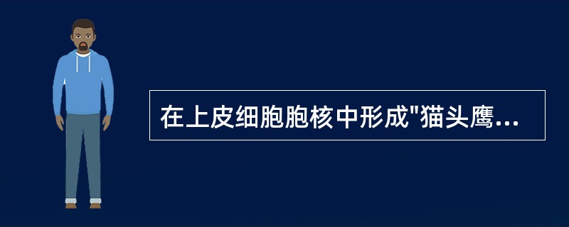 在上皮细胞胞核中形成"猫头鹰眼"样包涵体的病毒是A、人类巨细胞病毒B、人类免疫缺