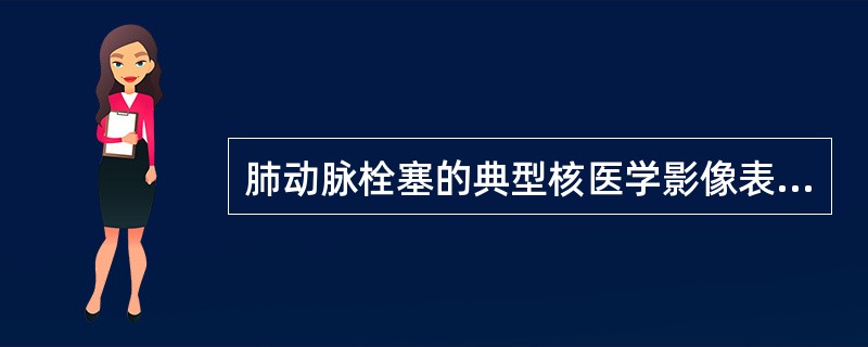 肺动脉栓塞的典型核医学影像表现是A、肺灌注显像表现为多发肺段性放射性稀疏或缺损,