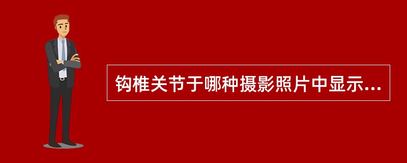 钩椎关节于哪种摄影照片中显示A、颈椎张口位B、第3~7颈椎前后位C、颈椎侧位片D