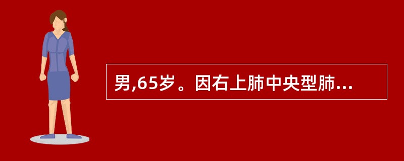 男,65岁。因右上肺中央型肺癌导致气管狭窄,今日症状加重入院。咳嗽呈阵发性,咳嗽