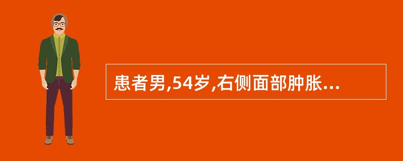 患者男,54岁,右侧面部肿胀,麻木2月余,伴流涕,CT显示右侧上颌窦内软组织密度