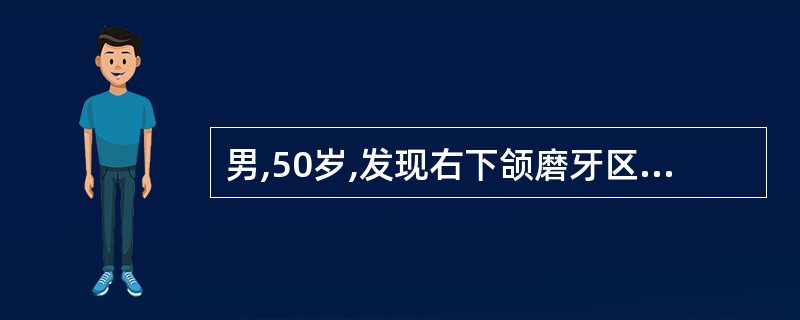 男,50岁,发现右下颌磨牙区牙龈溃疡4个月。体检:右下颌磨牙区牙龈溃疡较深,呈菜