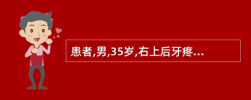 患者,男,35岁,右上后牙疼痛3天,冷热刺激疼痛加重。检查:右上第一、第二磨牙叩