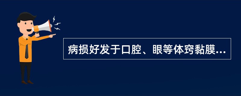 病损好发于口腔、眼等体窍黏膜,又称为黏膜类天疱疮的疾病是( )A、寻常型天疱疮B