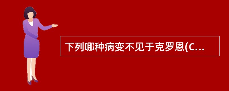 下列哪种病变不见于克罗恩(Crohn)病A、黏膜出现裂隙状溃疡B、出现肉芽肿C、