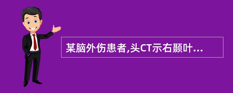 某脑外伤患者,头CT示右颞叶梭形高密度影,脑室中线受压移位,其诊断是A、硬膜外血