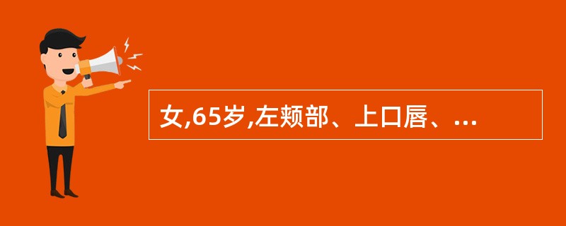 女,65岁,左颊部、上口唇、齿龈部呈闪电样刀割性剧痛,持续数秒,间歇期完全正常,