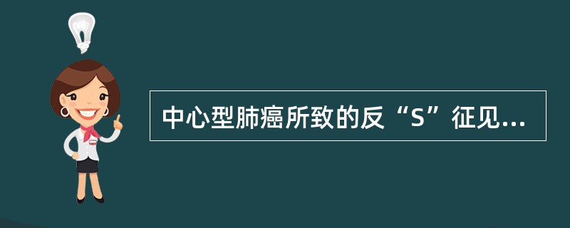 中心型肺癌所致的反“S”征见于( )。A、左肺上叶中心型肺癌B、右肺上叶中心型肺