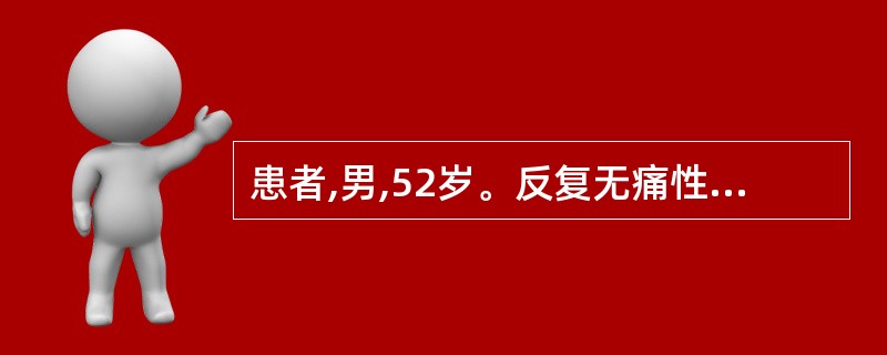 患者,男,52岁。反复无痛性肉眼血尿伴条状血块2个月,膀胱镜检见右输尿管口喷血,