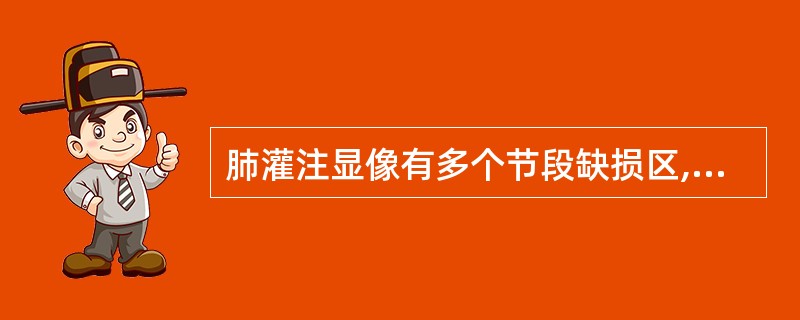 肺灌注显像有多个节段缺损区,且通气£¯灌注显像不匹配A、肺栓塞可以排除B、肺栓塞