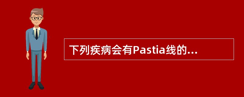 下列疾病会有Pastia线的是A、麻疹B、风疹C、猩红热D、手足口病E、单纯疱疹