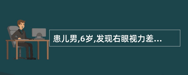 患儿男,6岁,发现右眼视力差2个月。Vod指数£¯10cm,右眼压33mmHg,