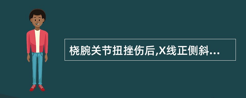 桡腕关节扭挫伤后,X线正侧斜位体可见( )。A、神经损伤B、血管损伤C、骨折D、