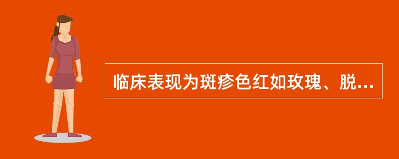 临床表现为斑疹色红如玫瑰、脱屑如糠枇的皮肤病应为( )A、风热疮B、黄水疮C、蛇