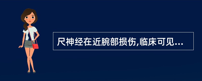 尺神经在近腕部损伤,临床可见的症状是A、手前旋,手指半屈B、掌指关节伸肌瘫痪C、