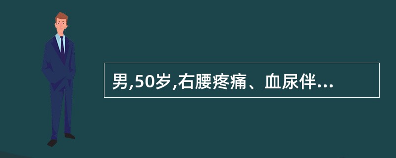 男,50岁,右腰疼痛、血尿伴低热3个月。B超发现右肾下极肿瘤直径约8cm,同时发
