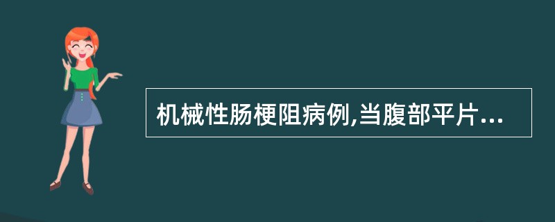 机械性肠梗阻病例,当腹部平片中显示下列何项变化时应考虑绞窄性肠梗阻可能( )A、