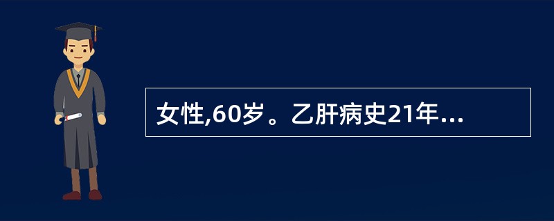 女性,60岁。乙肝病史21年,反复出现呕血和发热,1个月前腹胀加重,右上腹胀痛,
