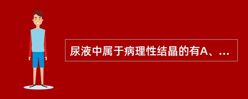 尿液中属于病理性结晶的有A、尿酸铵结晶B、胆红素结晶C、磷酸铵镁结晶D、胆固醇结